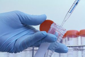 Lab Technician Takes Sample From Tube For Test